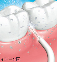 ジェットウォッシャー